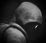 Subject 105